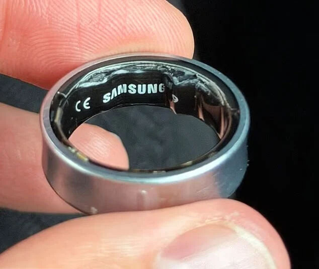 Ünlü YouTuber akıllı yüzüğü yüzünden hastanelik oldu! O anları sosyal medya hesabından paylaştı - 1. Resim