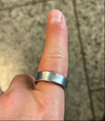 Ünlü YouTuber akıllı yüzüğü yüzünden hastanelik oldu! O anları sosyal medya hesabından paylaştı - 3. Resim