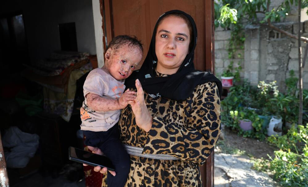 Tedavi gören Yusuf'un yardım için açılan Tiktok hesabını çaldılar! Utanmadan ailesinden para istediler Tedavi gören Yusuf'un yardım için açılan Tiktok hesabını çaldılar! Utanmadan ailesinden para istediler - 1. Resim