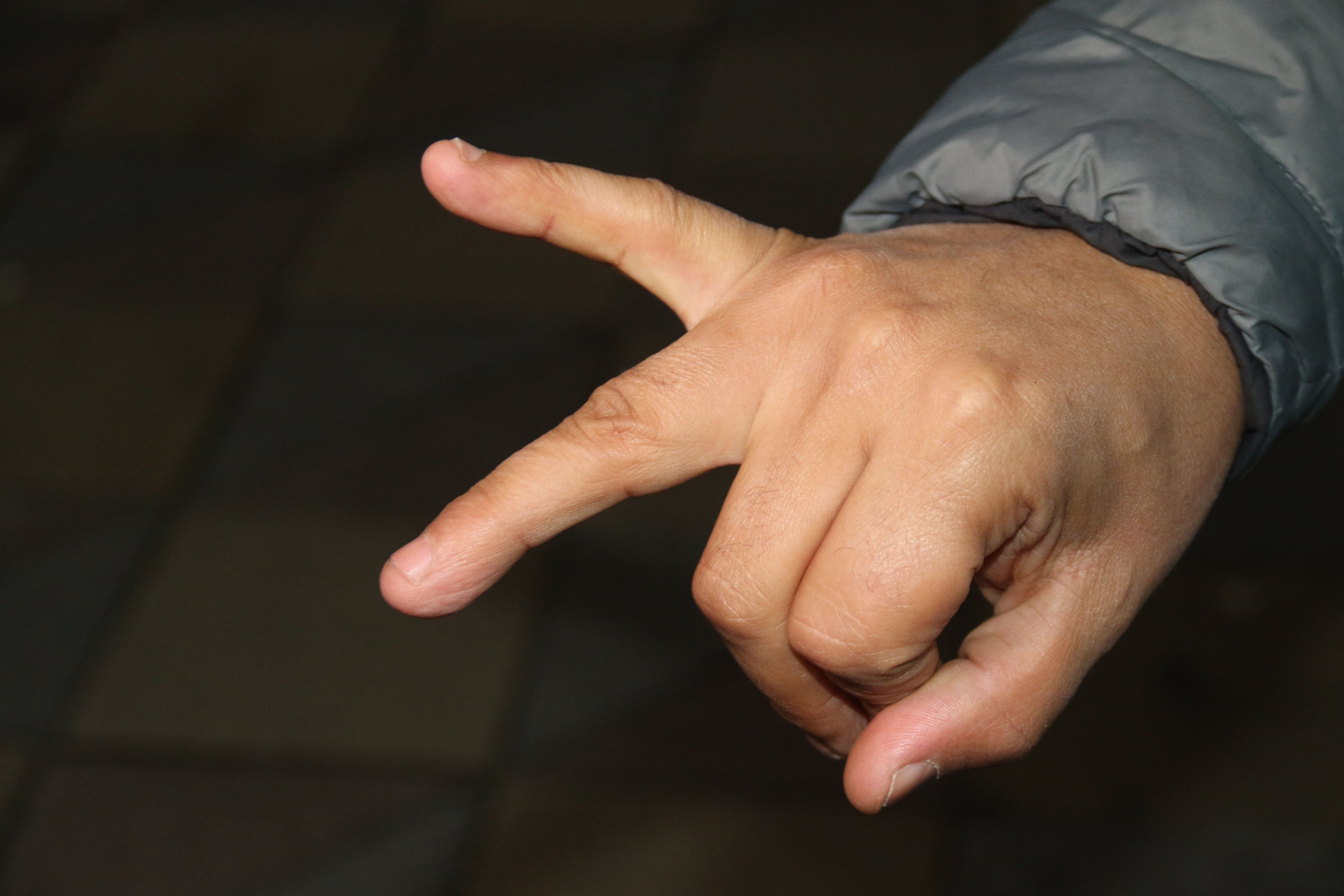 Bozuk balık 'çolak' bıraktı: Çuprayla adam dövdüler! - 3. Resim