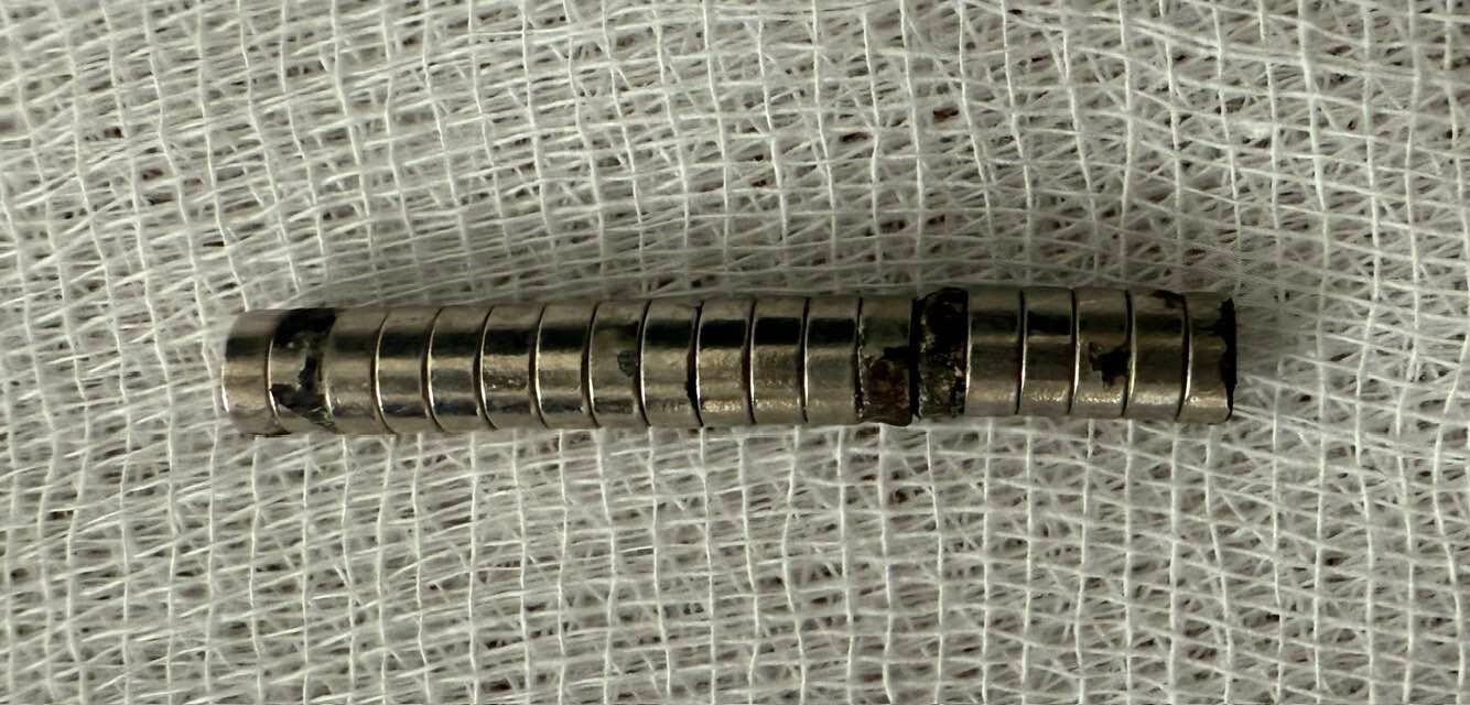 Kimse nasıl olduğunu anlamadı! Küçük çoğunu boğazından 19 mıknatıs çıktı - 2. Resim