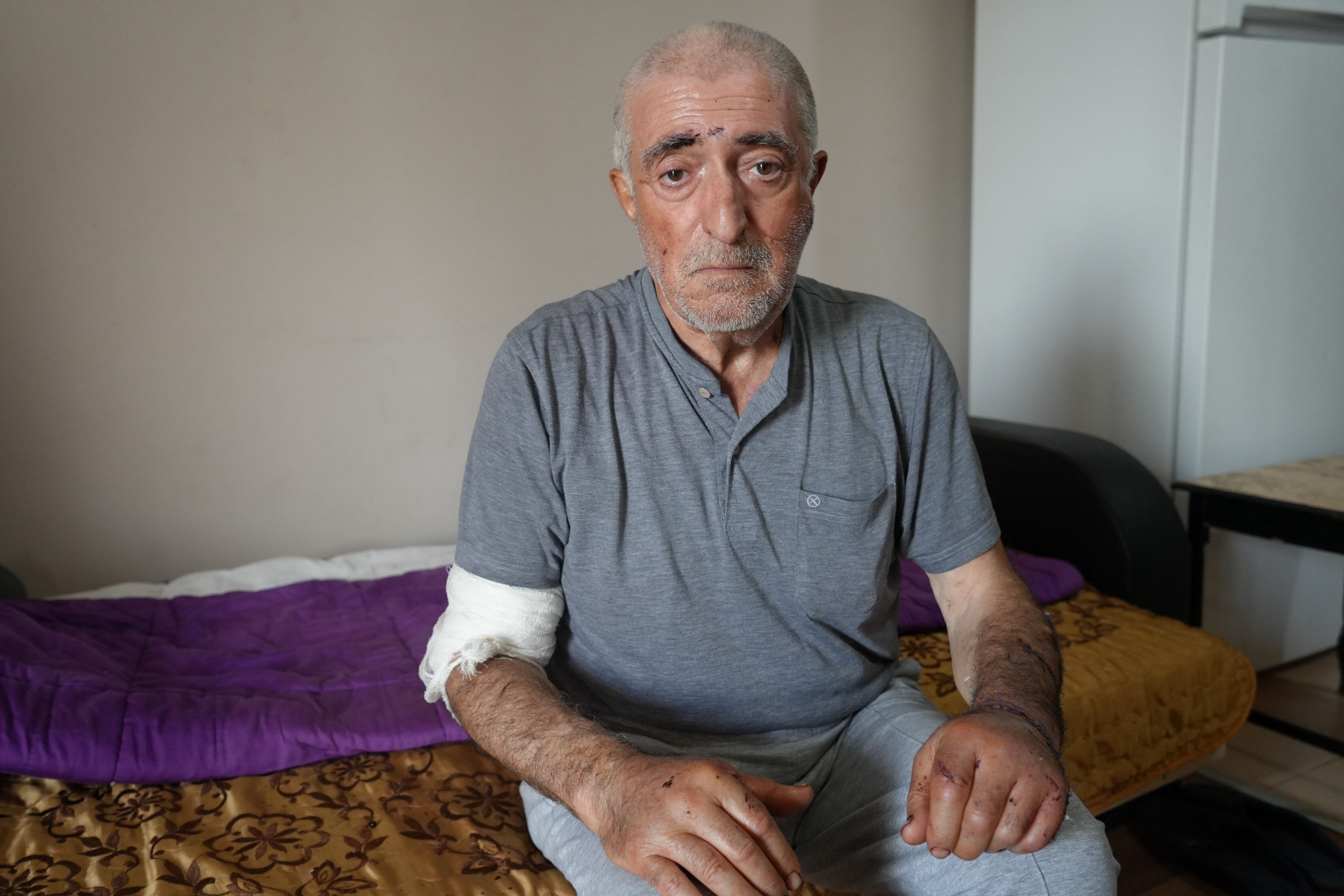 Kendisini 17 yerinden bıçaklayan eşini affetti, evsiz kaldı: Kendim ettim, kendim buldum - 7. Resim