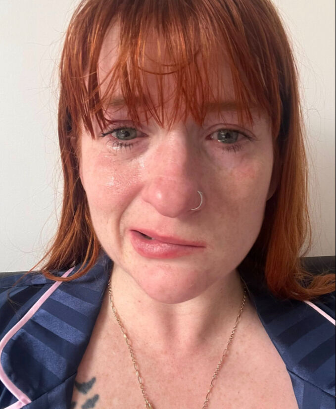 Alerji olduğunu sandı, gerçek bambaşka çıktı! Genç kadın doğumundan sonra kabusu yaşadı - 2. Resim