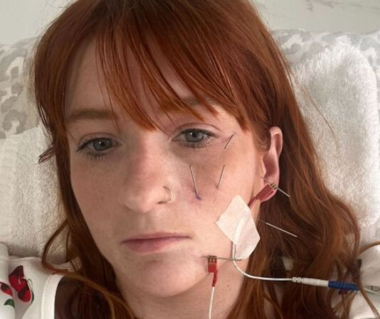 Alerji olduğunu sandı, gerçek bambaşka çıktı! Genç kadın doğumundan sonra kabusu yaşadı - 1. Resim