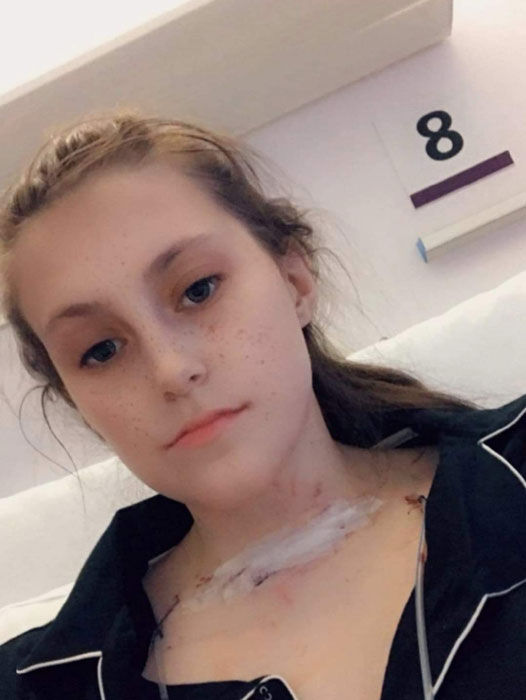 Basit bir döküntüyle gitti… Doktorun dikkati sayesinde 5 yıllık gizli hastalığı ortaya çıktı - 4. Resim