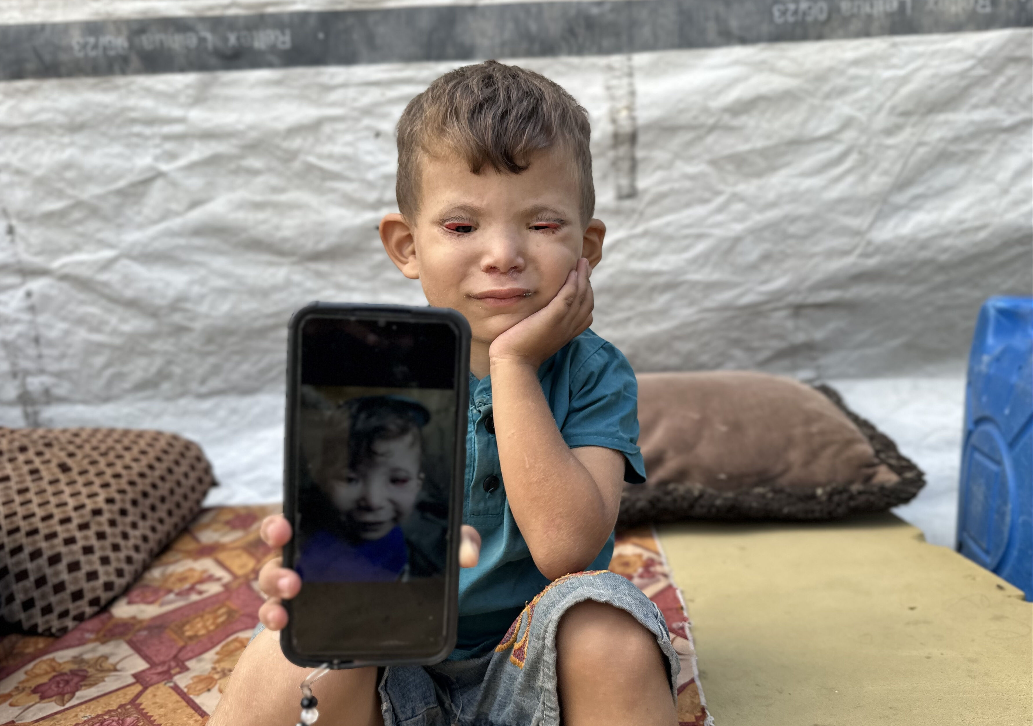 Kıtlıkla kuşatılan Gazze’de 'göz kapağı' hastası 3 yaşındaki Ramez yardım bekliyor - 3. Resim