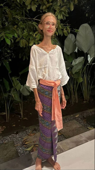 Uyguladığı meyve diyeti sonu oldu! 22 kiloya düşen fenomen otelde ölü bulundu - 2. Resim