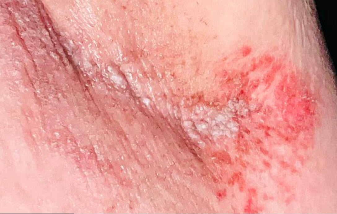 Ünlü markanın deodorantı ciltlerini yaktı! Yüzlerce kadın kabusu yaşadı - 3. Resim