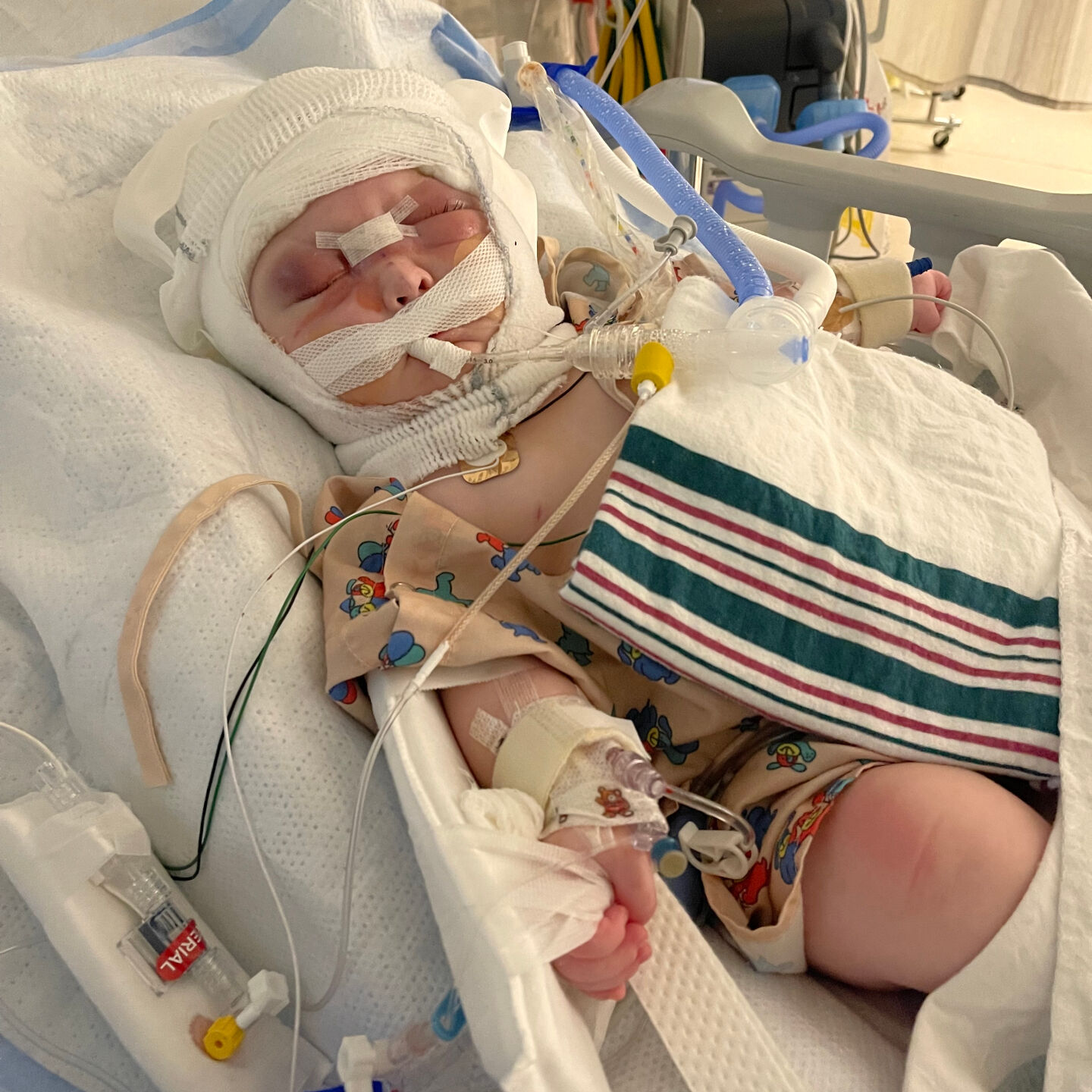 Doğduğunda beyninin bir kısmı kafatasının dışındaydı! Görenler hayret etti - 1. Resim