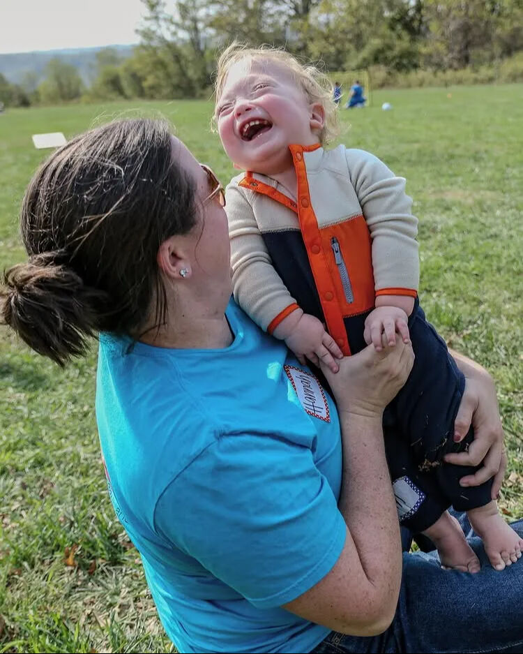 Doğduğunda beyninin bir kısmı kafatasının dışındaydı! Görenler hayret etti - 3. Resim