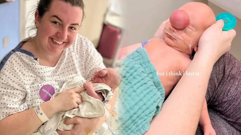 Doğduğunda beyninin bir kısmı kafatasının dışındaydı! Görenler hayret etti - 2. Resim