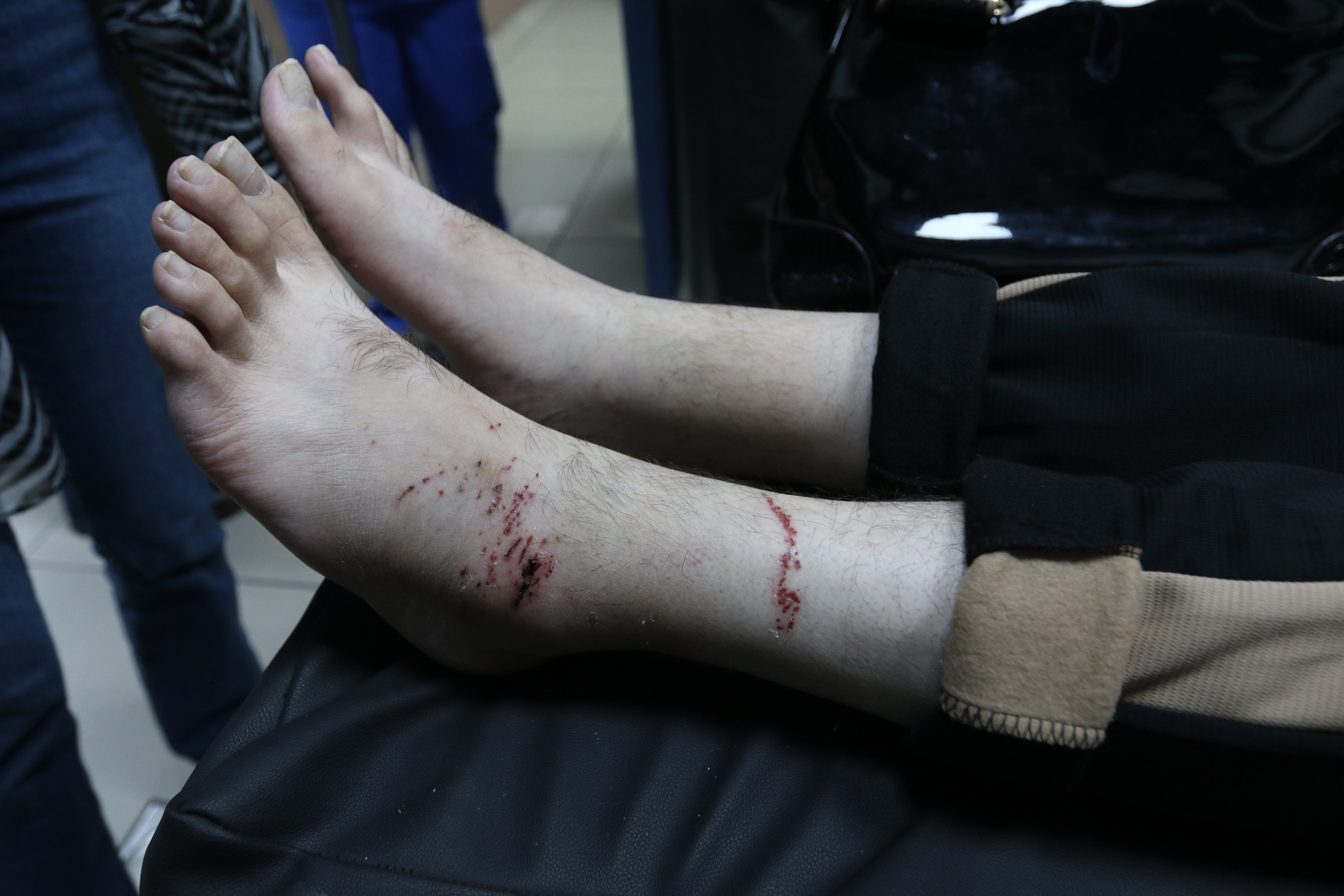 İsrail hapishanesinden kurtulan Filistinli mahkum gördükleri zulmü anlattı! Türkiye ile Erdoğan'a teşekkür etti - 2. Resim