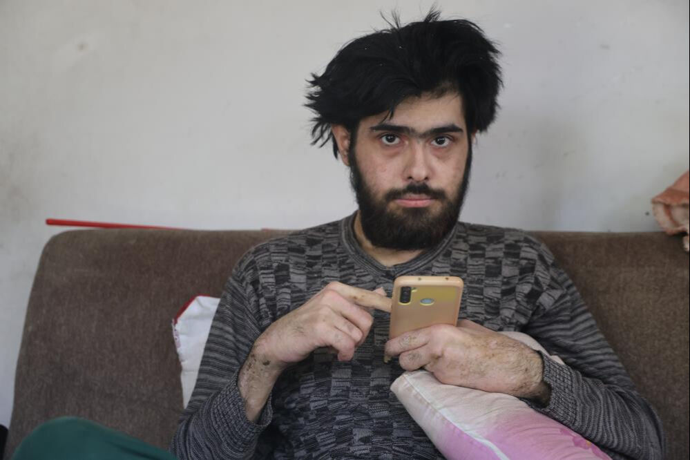 6 Şubat depremi hayatını kararttı! 3 yıldır evden çıkmıyor, banyo yapmıyor, tırnak kesmiyor... - 3. Resim