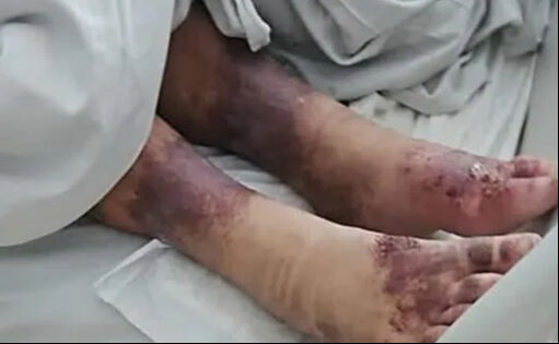 Polonya'da aile vahşeti: 27 yıl boyunca kayıp sanılmıştı... Meğer tek göz odaya hapsedilmiş - 2. Resim