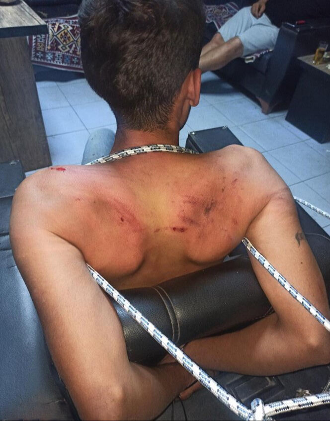 Antalya'da 3 gün süren vahşette istenen cezalar belli oldu! Dişlerini kırıp, hamam böceği yedirmişlerdi - 2. Resim