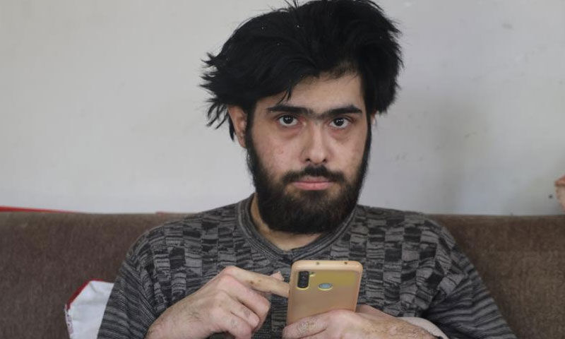 Ne duş alıyor ne tırnaklarını kesiyor… Telefon bağımlısı gencin eski hali ortaya çıktı - 2. Resim