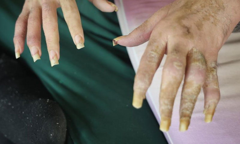 Ne duş alıyor ne tırnaklarını kesiyor… Telefon bağımlısı gencin eski hali ortaya çıktı - 4. Resim