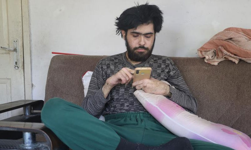 Ne duş alıyor ne tırnaklarını kesiyor… Telefon bağımlısı gencin eski hali ortaya çıktı - 1. Resim