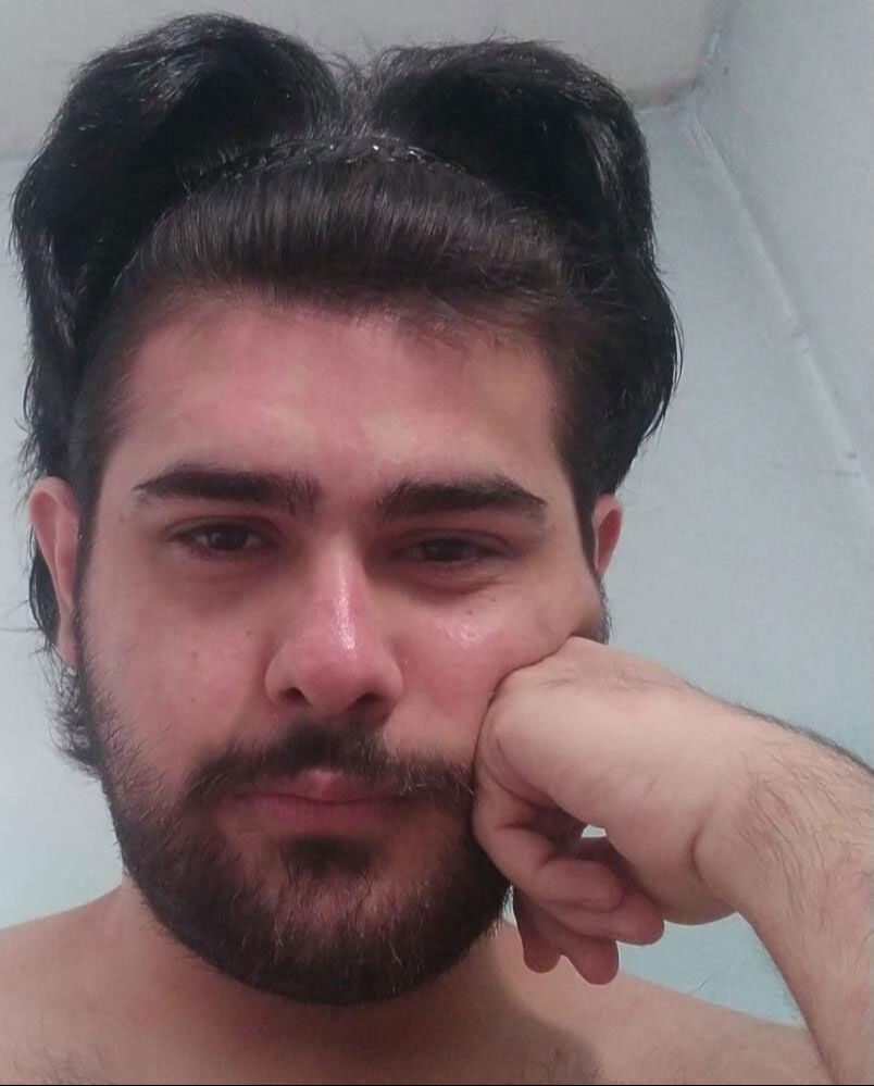 Ne duş alıyor ne tırnaklarını kesiyor… Telefon bağımlısı gencin eski hali ortaya çıktı - 7. Resim