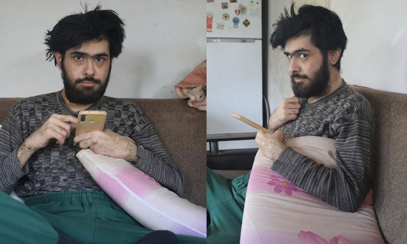 3 yılın ardından tıraş oldu, duş aldı ama hala umudu yok! Barış Özbay: Tedavi olmak istemiyorum - 1. Resim