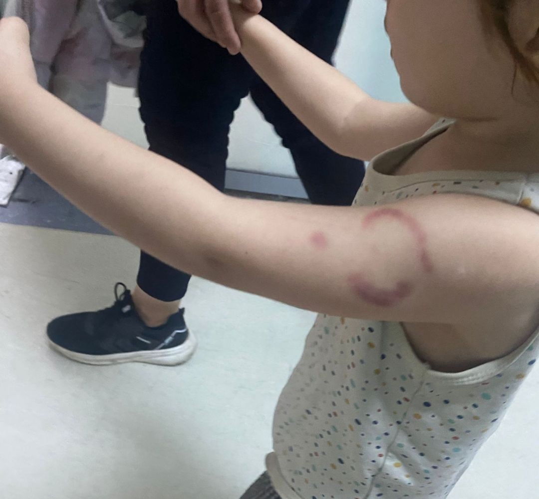 Öperken olduğunu iddia etmişti: Edirne'de öğrencisini ısıran öğretmen tutuklandı - 2. Resim