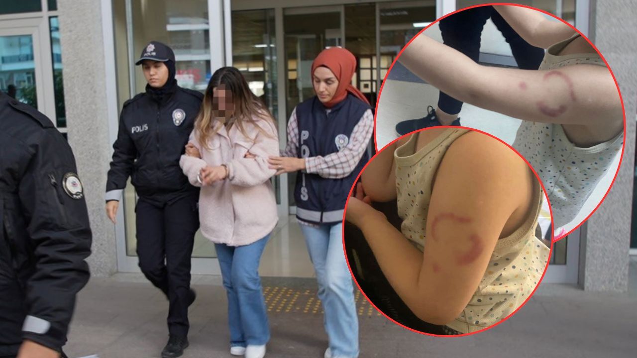  -Öğrencisini ısıran öğretmen tutuklandı