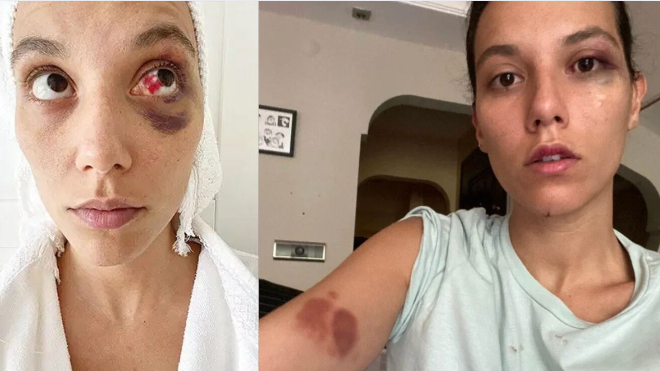 Deniz Bulutsuz kimdir, kaç yaşında, nereli? Ozan Güven'e hapis cezası sonrası merak edildi! - 2. Resim