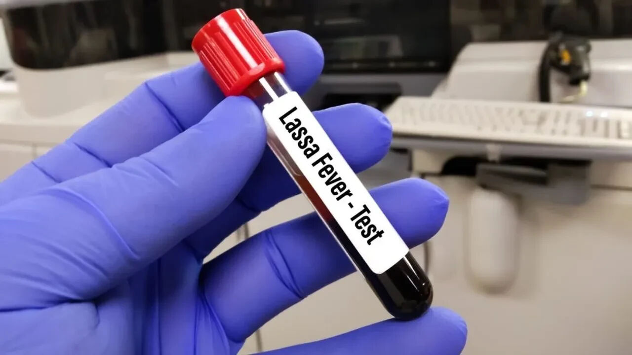 Nijerya'da Lassa kabusu! Bilanço günden güne ağırlaşıyor - 1. Resim