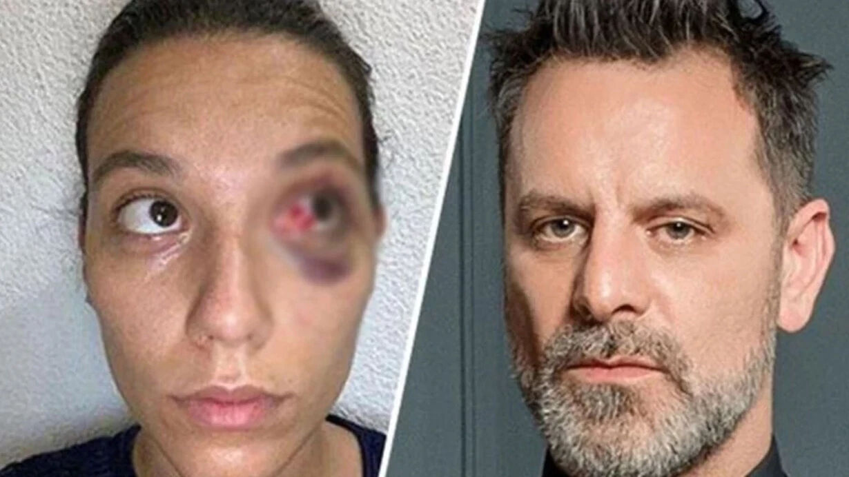 Ozan Güven cezaevine girecek mi, ceza aldı mı? Deniz Bulutsuz olayına ilişkin detaylar gündemde - 3. Resim