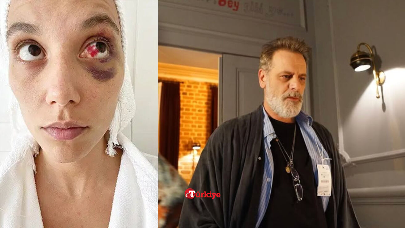 Ozan Güven cezaevine girecek mi, ceza aldı mı? Deniz Bulutsuz olayına ilişkin detaylar gündemde - 2. Resim