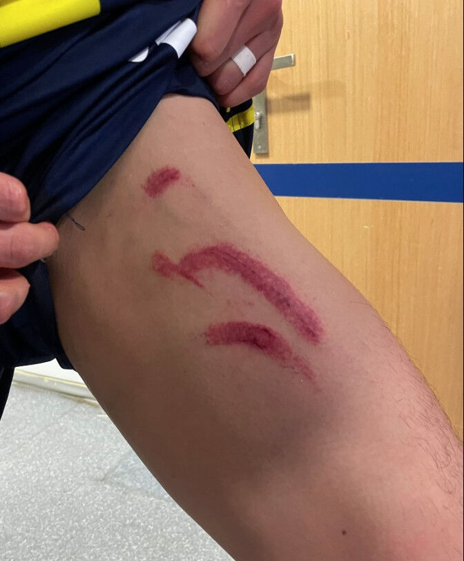 Acımasız faulle yerde kalmıştı! Edson Alvarez'den maç sonu 'sakatlık' sözleri Acımasız faulle acılar içinde yerde kalmıştı! Edson Alvarez'den maç sonu 'sakatlık' açıklaması - 2. Resim