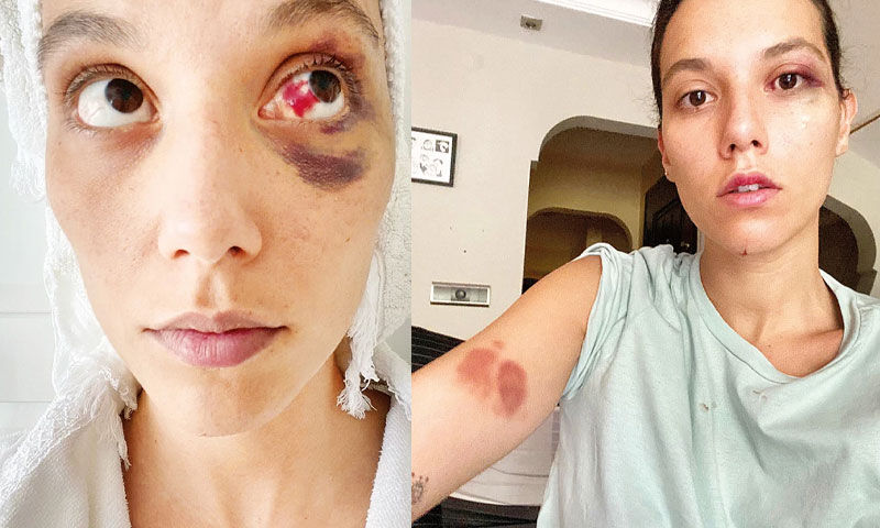 45 günlük hapis kararı sonrası Ozan Güven sessizliği bozdu! Deniz Bulutsuz’a sert mesaj… 45 günlük hapis kararı sonrası Ozan Güven sessizliği bozdu! Deniz Bulutsuz’a sert mesaj… - 1. Resim