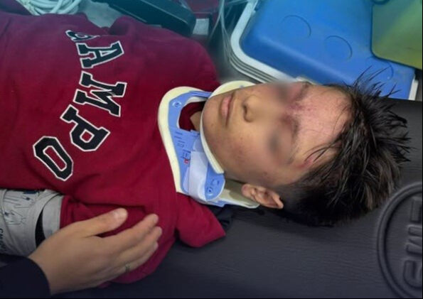 Okul çıkışında izdiham yaşandı! Erzurum'daki korkunç olayda 23 öğrenci yaralandı - 3. Resim