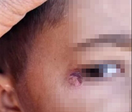 Şanlıurfa'da temizlik görevlisi, öğrenciyi darbedip yüzünde sigara söndürdü! Şanlıurfa'da temizlik görevlisi, öğrenciyi darbedip yüzünde sigara söndürdü! - 1. Resim