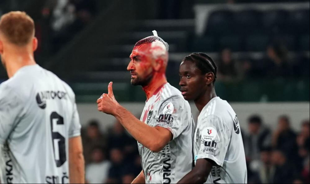 Serdar Dursun yürekleri ağza getirdi: Kanlar içinde kaldı Serdar Dursun yürekleri ağza getirdi: Kanlar içinde kaldı - 1. Resim