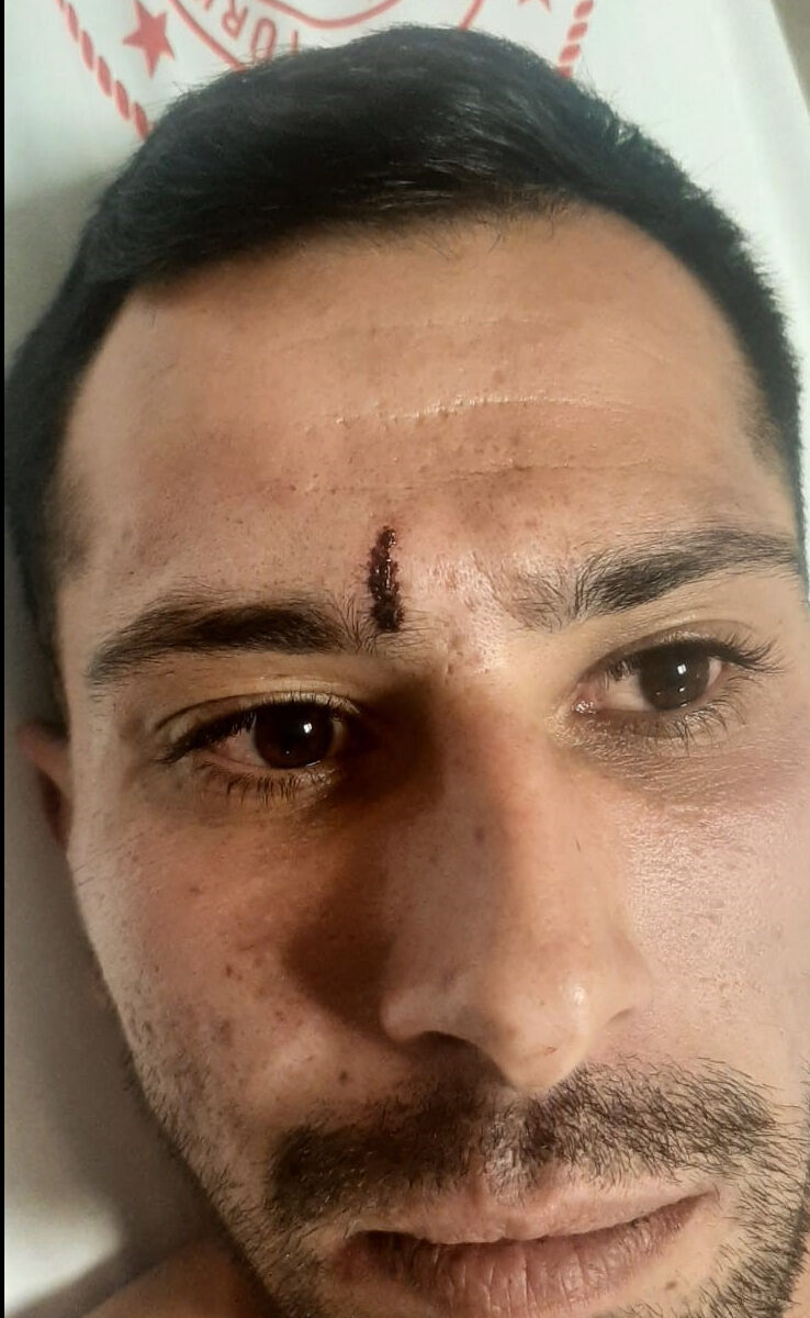 Bucak Belediyesi etkinliğinde olay! "Rabia ve bozkurt" işareti yüzünden darp iddiası Bucak Belediyesi etkinliğinde olay! "Rabia ve bozkurt" işareti yüzünden darp iddiası - 3. Resim