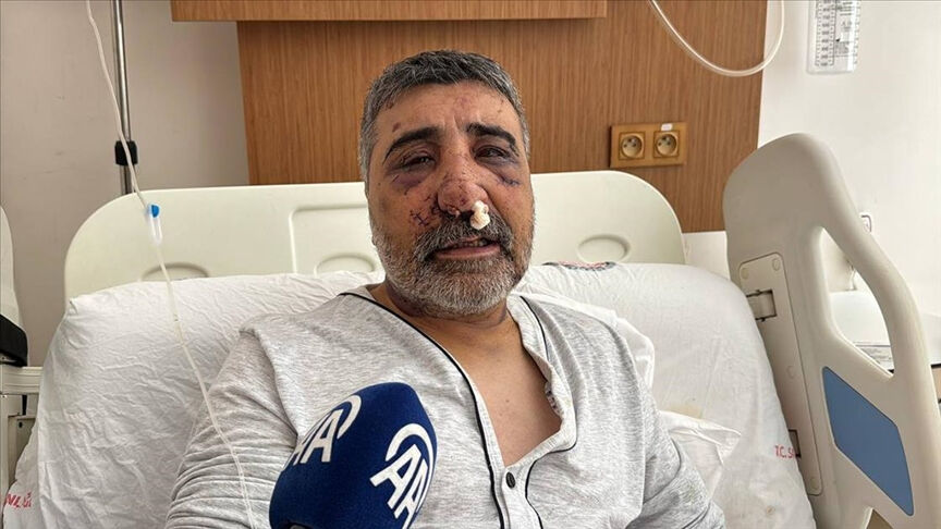 İngiliz turistin taksiciye yaşattıkları günlerce konuşulmuştu: Gözüm kör oldu, her gece bağırarak uyanıyorum İngiliz turistin taksiciye yaşattıkları günlerce konuşulmuştu: Gözüm kör oldu, her gece bağırarak uyanıyorum - 1. Resim