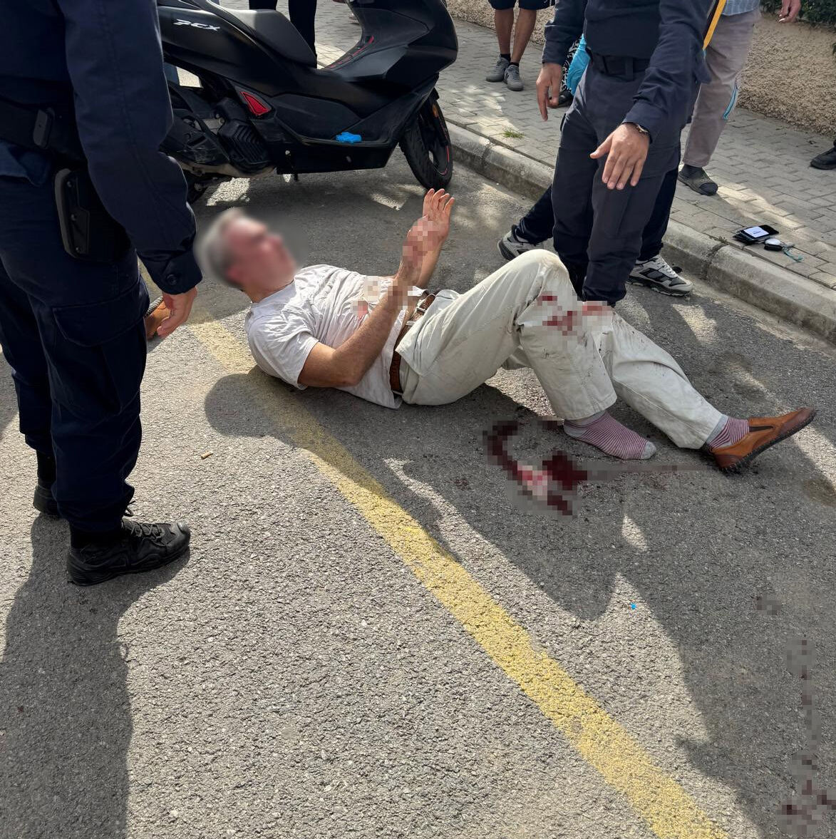 Rus uyruklu çiftin tartışmasında kan döküldü! Korkutan anlar kamerada Rus uyruklu çiftin tartışmasında kan döküldü! Kan donduran anlar - 2. Resim