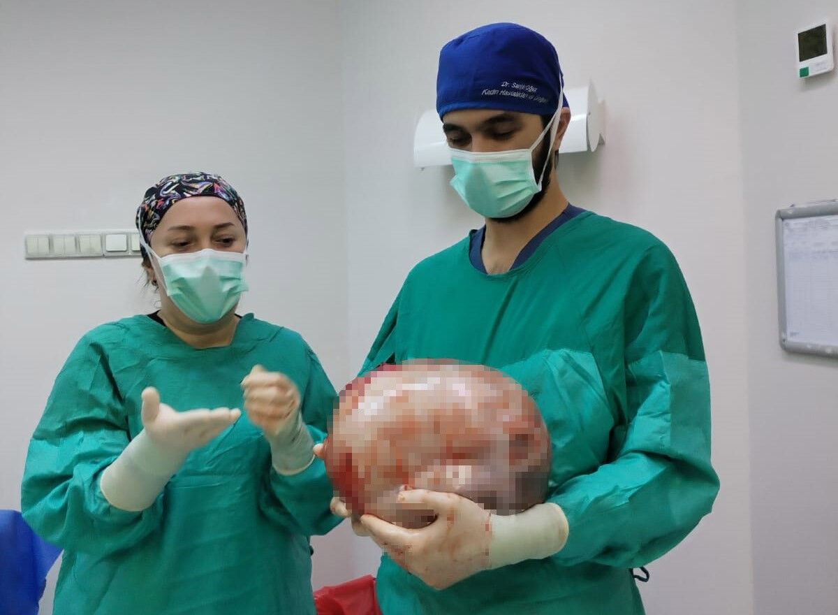 Sadece 2 ayda 9 aylık hamilelere döndü! Gerçek ortaya çıkınca büyük şok yaşandı Sadece 2 ayda 9 aylık hamilelere döndü! Gerçek ortaya çıkınca büyük şok yaşandı - 1. Resim