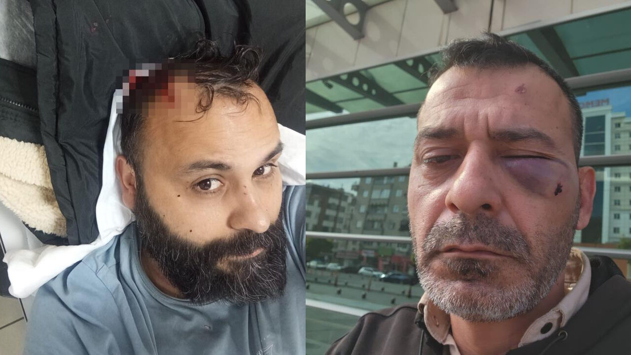 Sosyal medya fenomenine dehşeti yaşattılar! Adem Ocaktan ve 13 yaşındaki oğluna korkunç saldırı Sosyal medya fenomenine dehşeti yaşattılar! Adem Ocaktan ve 13 yaşındaki oğluna korkunç saldırı - 2. Resim