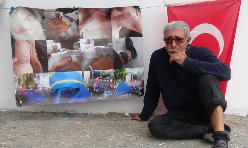 İnternetten tanıştığı eşi bıçakladı, evinden oldu! Şimdi ayağında kelepçeyle çadırda yaşıyor - 5. Resim