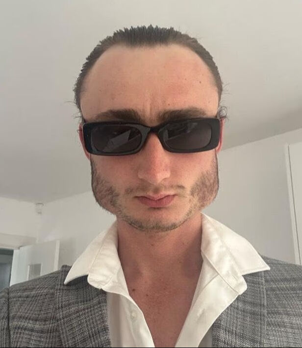 Sosyal medya bu genci konuşuyor! Yaptığı spor yüzünün şeklini değiştirdi Sosyal medya bu genci konuşuyor! Yaptığı spor yüzünün şeklini değiştirdi - 2. Resim