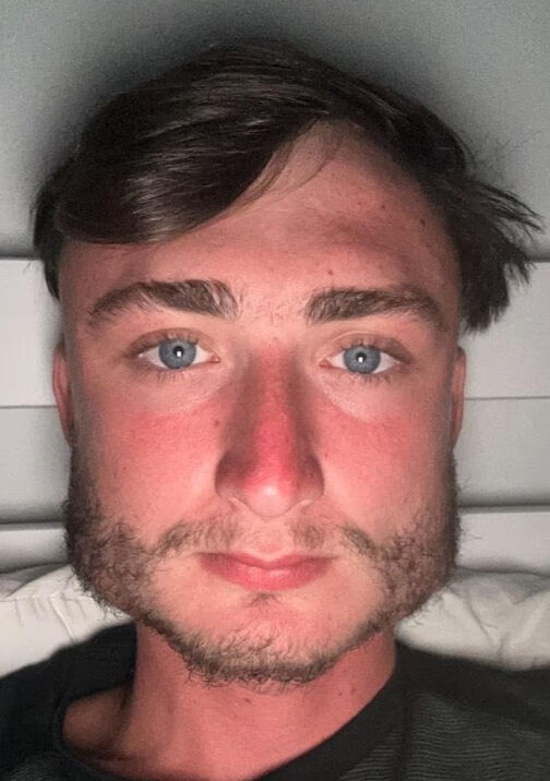 Sosyal medya bu genci konuşuyor! Yaptığı spor yüzünün şeklini değiştirdi Sosyal medya bu genci konuşuyor! Yaptığı spor yüzünün şeklini değiştirdi - 1. Resim