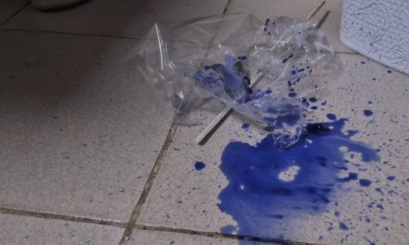 Pamuk şeker kabusu! 5 yaşındaki çocuk ağzı köpürerek kusmaya başladı Pamuk şeker kabusu! 5 yaşındaki çocuk ağzı köpürerek kusmaya başladı - 3. Resim