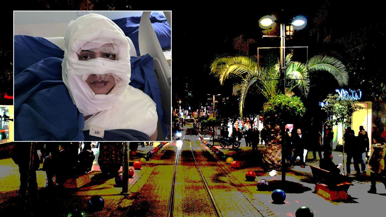 Donna di 33 anni vittima di un attacco brutale a Kadıköy: ustioni gravi e arresto dell'aggressore