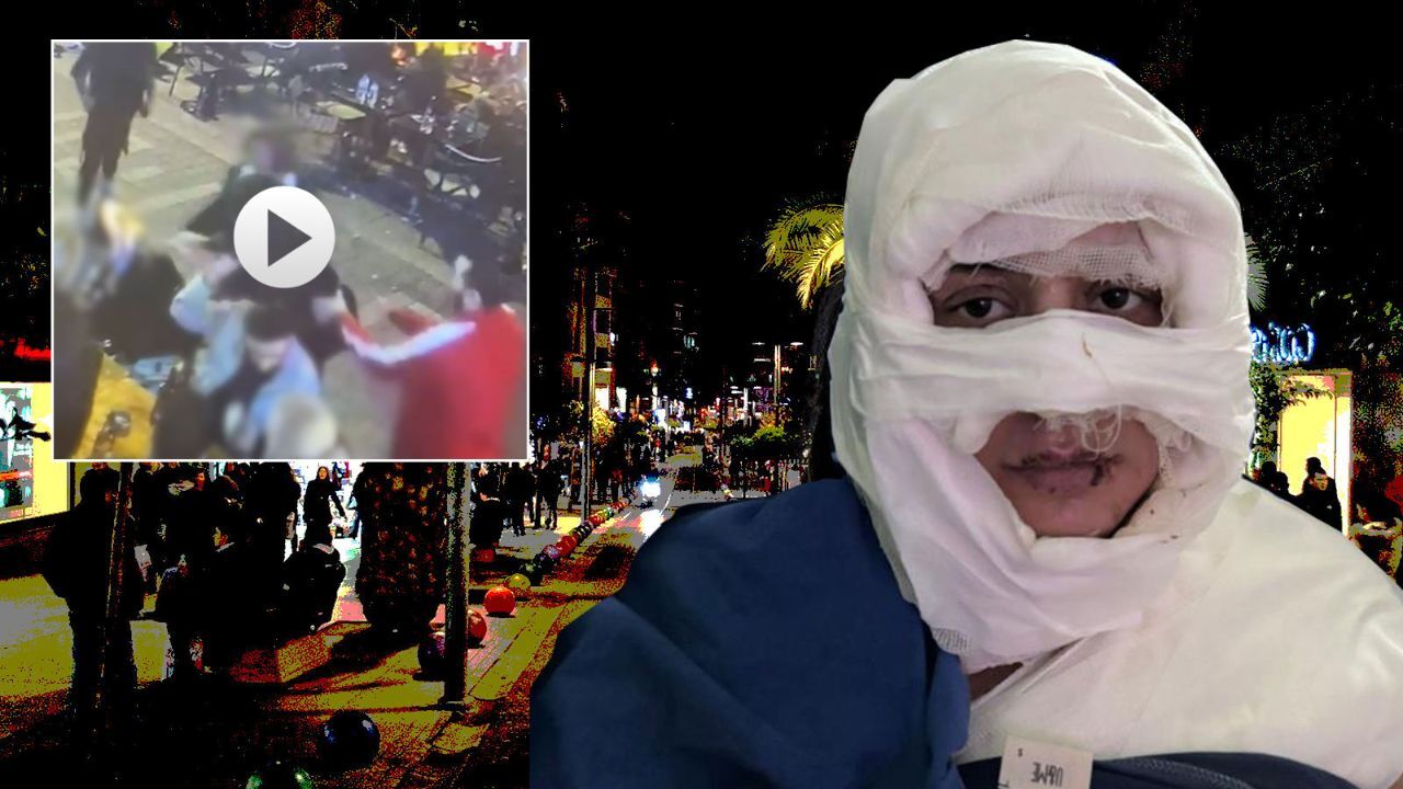  -Genç kadına yanıcı madde döküp yaktı!