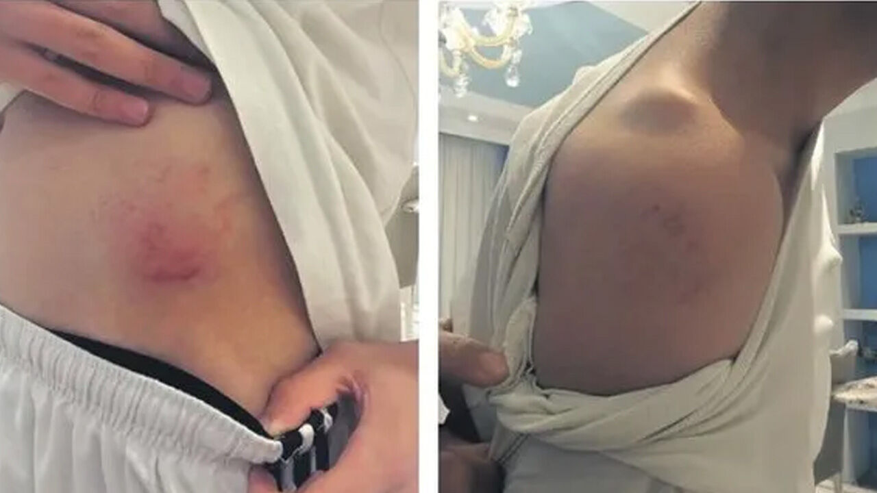 Lisede ördek yürüyüşü skandalı! Sözde 'disiplin cezası' öğrencileri hastanelik etti - 1. Resim