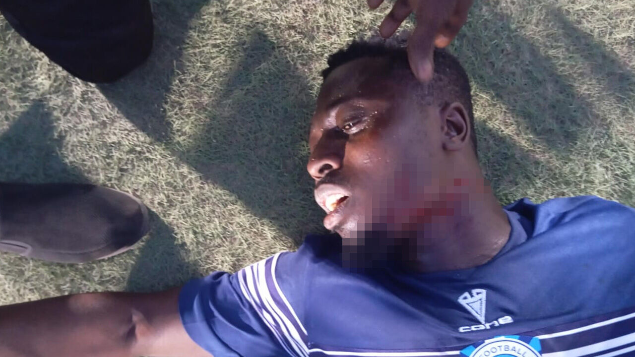 Sahaya girdiler, futbolcunun boğazını kestiler! Yeşil sahada akılalmaz olay Sahaya girdiler, futbolcunun boğazını kestiler! Yeşil sahada akılalmaz olay - 1. Resim