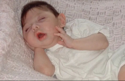 Beyni olmadan dünyaya gelmişti: Doktorlar 5 yıl bile yaşamaz dedi, şimdi 20 yaşında - 2. Resim