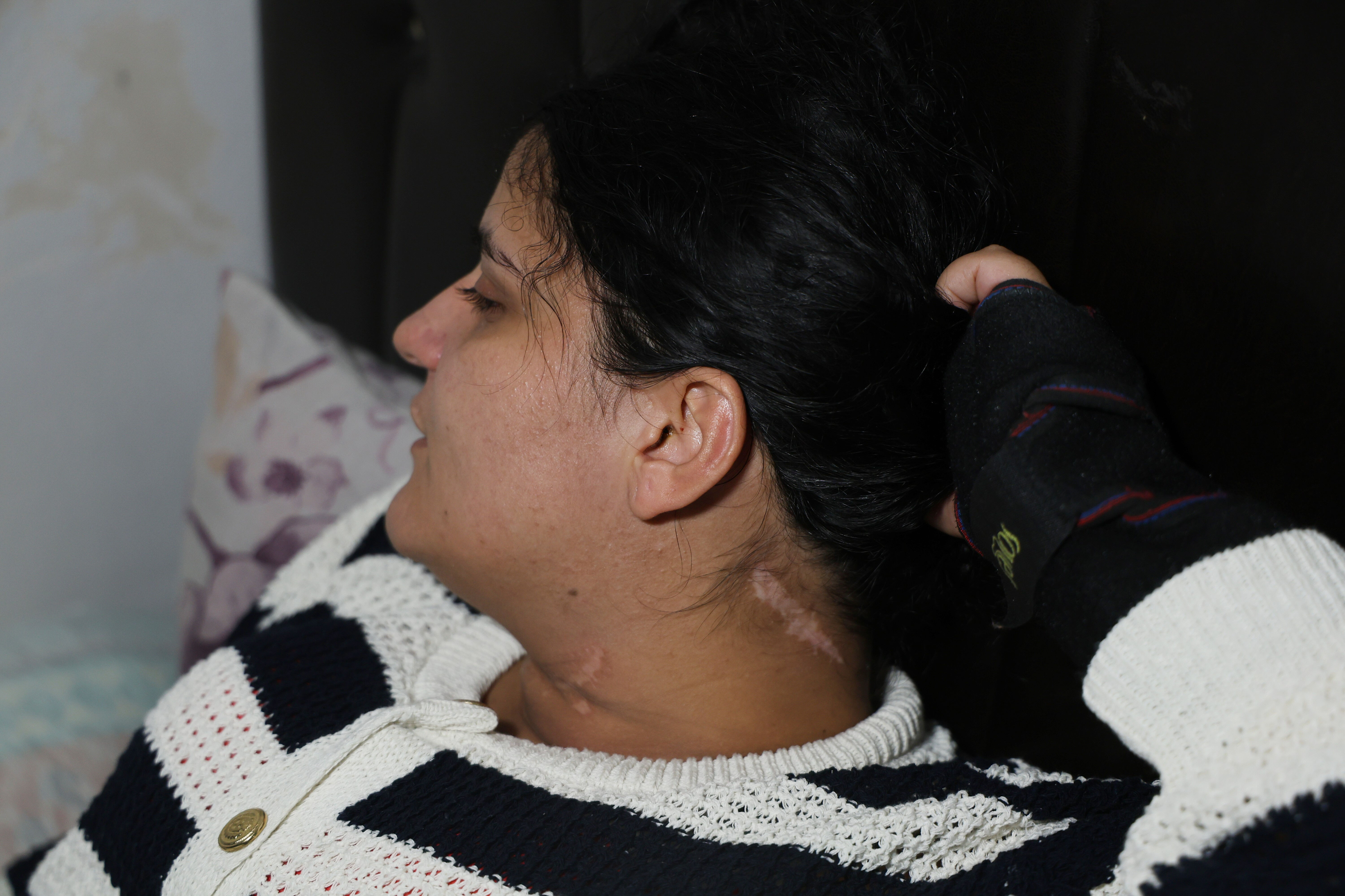 Eşi canına kıymak istedi, ölme numarasıyla kurtuldu! Nazmiye Çalışkan'ın başına gelenler kabus gibi - 3. Resim